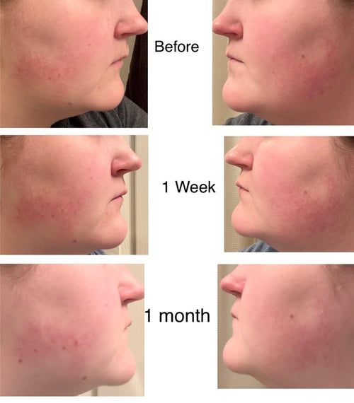 COS DE BAHA - AZELAIC ACID 10 SERUM
