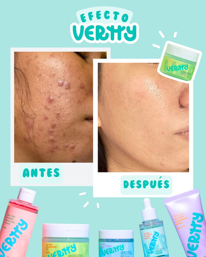 VERTTY - TEA TREE AC CLEANSING FOAM