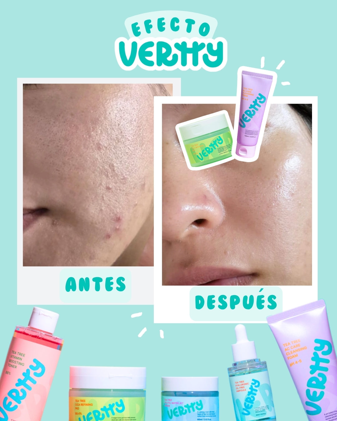 VERTTY - TEA TREE AC CLEANSING FOAM