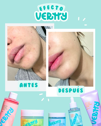 VERTTY - TEA TREE AC CLEANSING FOAM